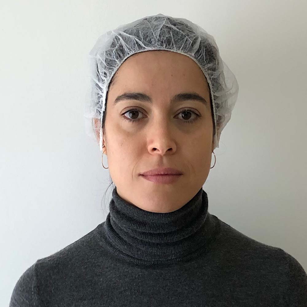 bichectomia-sevilla-antes