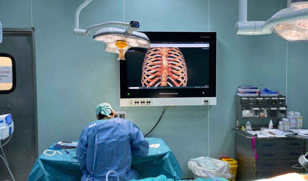 reconstrucción-auricular