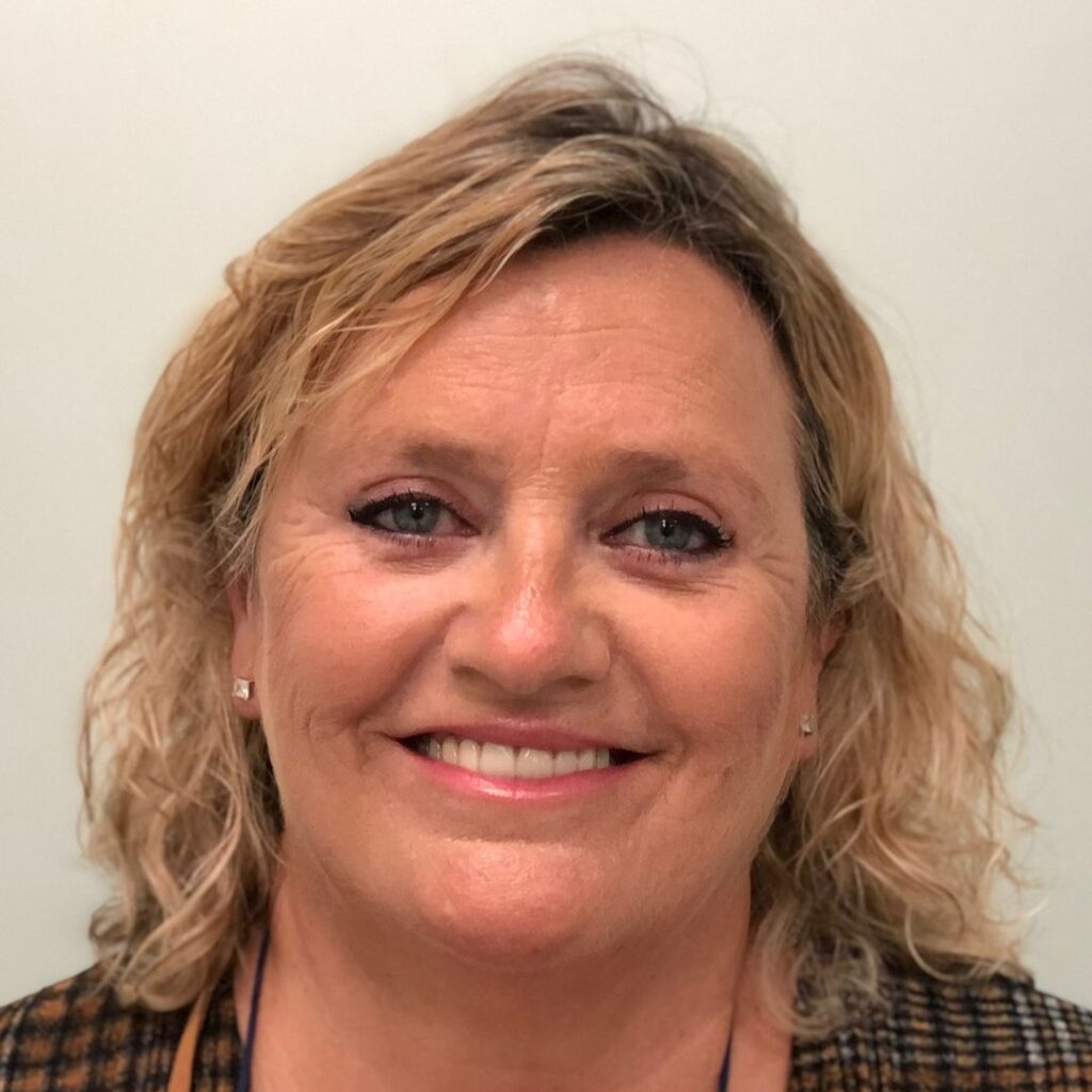 blefaroplastia 10 despues