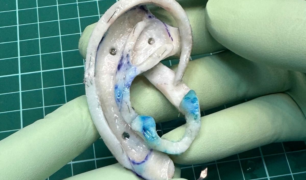 reconstruccion-auricular-cartilago