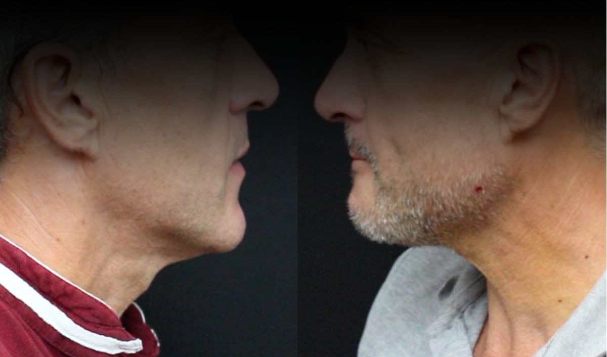 masculinizacion-estetica