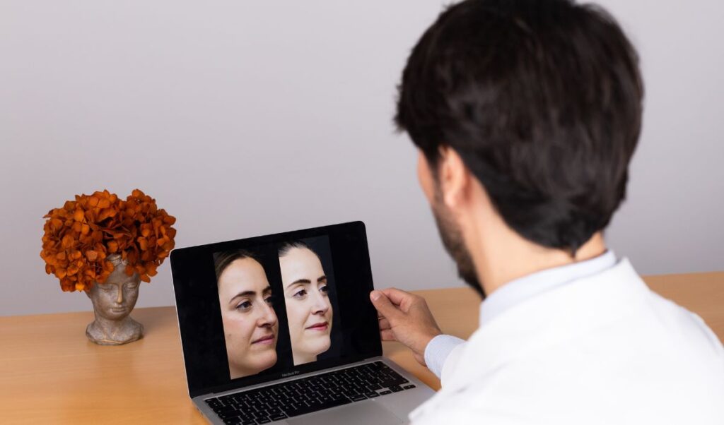 postoperatorio-rinoplastia-ultrasonica