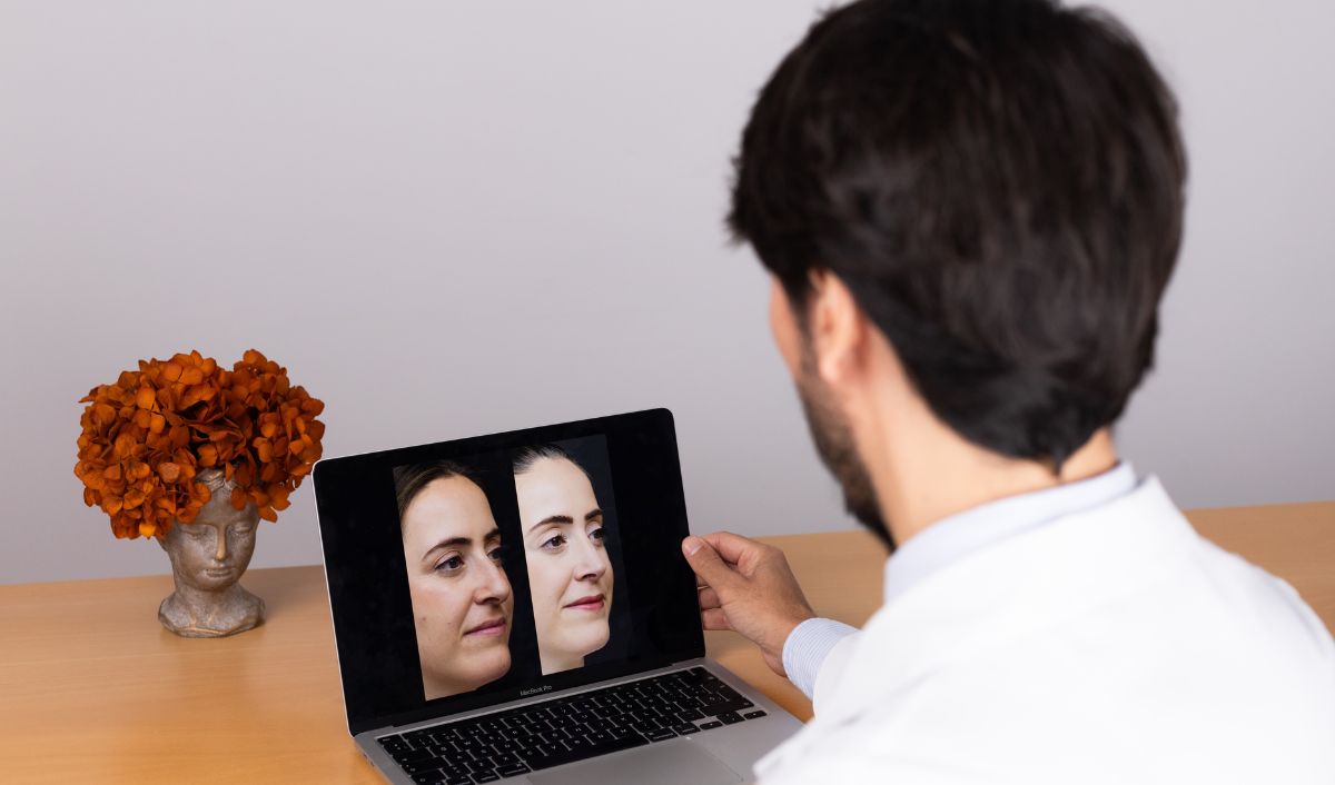 postoperatorio-rinoplastia-ultrasonica